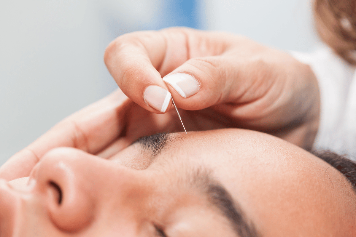 masaje facial con acupuntura técnica china milenaria